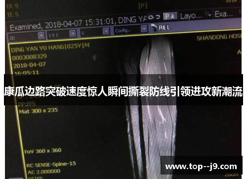 康瓜边路突破速度惊人瞬间撕裂防线引领进攻新潮流